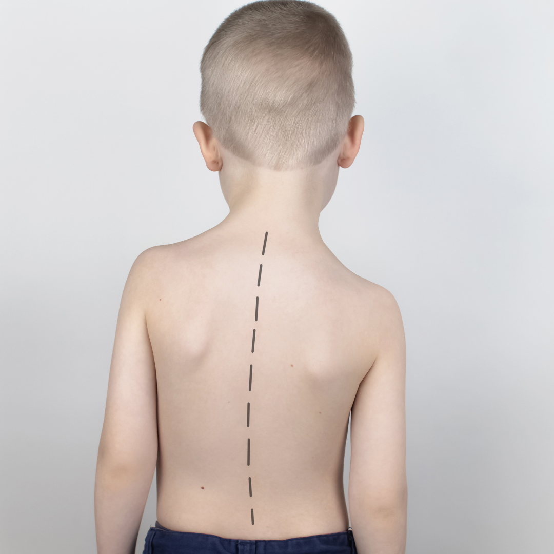 Learn about recent changes in pediatric scoliosis care at Temple Street Hospital, including findings on governance, reforms, and improved treatment protocols.