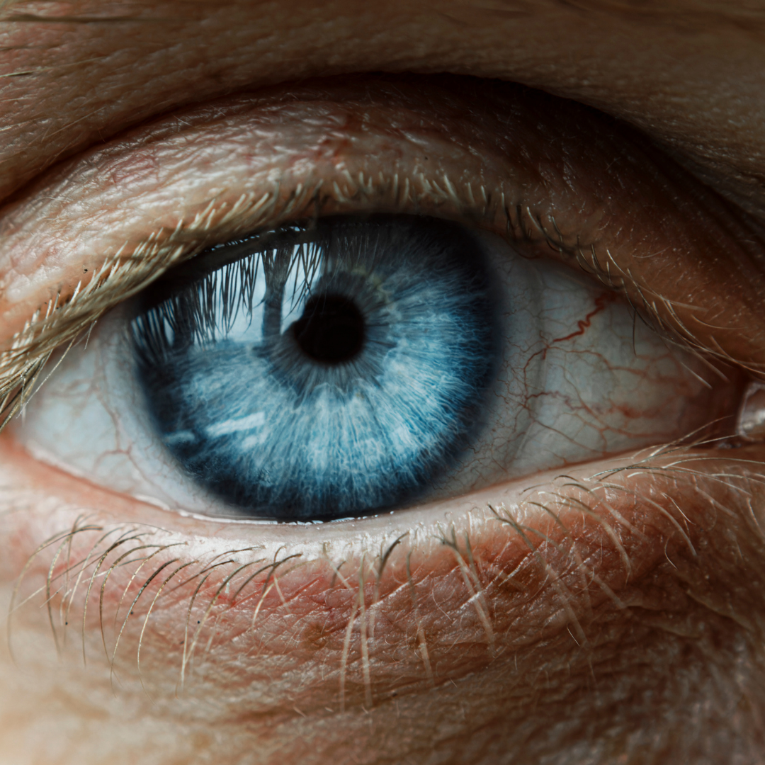 Learn about eye surgery negligence claims in Ireland. Understand your rights, time limits, and legal options if medical treatment caused harm. Expert legal guidance.