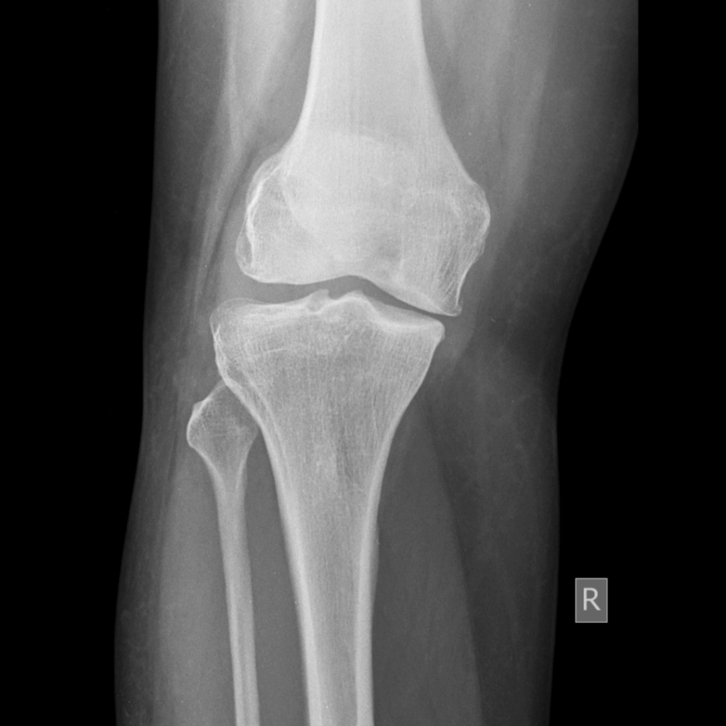 From whiplash and fractures to workplace illnesses, learn about the most common injuries suffered in accidents and your legal rights in Ireland.